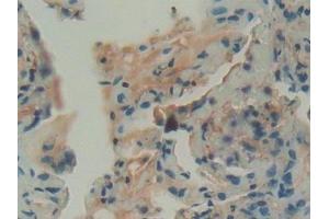 Immunohistochemistry (IHC) image for anti-Glucosidase, Beta, Acid (GBA) (AA 117-214) antibody (ABIN7434968)