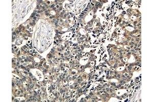 Immunohistochemistry (IHC) image for anti-DOK2 (DOK2) (pTyr299) antibody (ABIN3019935) (DOK2 抗体  (pTyr299))