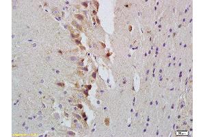 Formalin-fixed and paraffin embedded rat brain labeled with Rabbit Anti-STAT1 Polyclonal Antibody, Unconjugated  at 1:200 followed by conjugation to the secondary antibody and DAB staining (STAT1 抗体  (AA 251-380))