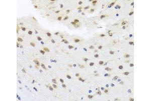 Immunohistochemistry of paraffin-embedded Mouse brain using HDAC4 Polyclonal Antibody at dilution of 1:100 (40x lens). (HDAC4 抗体)