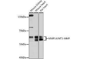 Western blot analysis of extracts of various cell lines, using MMP14/MMP14/MT1-MMP Rabbit mAb (ABIN7268420) at 1:1000 dilution. (MMP14 抗体)