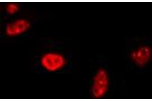 Immunofluorescent analysis of RAD17 staining in A549 cells. (RAD17 抗体  (C-Term))