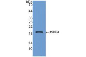 Western blot analysis of recombinant Human GCA. (Grancalcin 抗体  (AA 1-139))