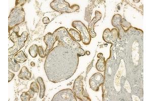ABIN6260919 and ABIN6277317 at 1/100 staining human normal placenta tissue by IHC-P. (CNTF Receptor alpha 抗体  (Internal Region))