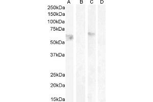 ABIN185484 (1 μg/mL) staining of HeLa lysate non-glycosylated (A) + peptide (B) and (0. (CNR1 抗体  (Internal Region))