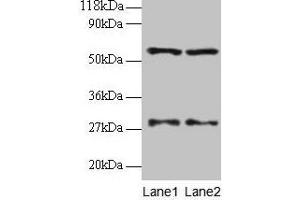 Western blot All lanes: SARS antibody at 2 μg/mL Lane 1: EC109 whole cell lysate Lane 2: 293T whole cell lysate Secondary Goat polyclonal to rabbit IgG at 1/15000 dilution Predicted band size: 59 kDa Observed band size: 59 kDa (Seryl-tRNA Synthetase (SARS) (AA 2-233) 抗体)