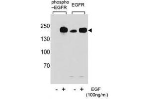 Western blot analysis of extracts from A431 cells,untreated or treated with EGF, using p-EGFR antibody (left) or nonphos Ab (right). (EGFR 抗体  (pTyr1069))