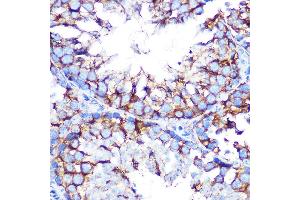 Immunohistochemistry of paraffin-embedded mouse testis using Muscarinic AChR M2 (Muscarinic AChR M2 ) Rabbit mAb (ABIN7266346) at dilution of 1:100 (40x lens). (Muscarinic Acetylcholine Receptor M2 抗体)