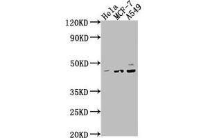 Western Blot Positive WB detected in: Hela whole cell lysate, MCF-7 whole cell lysate, A549 whole cell lysate All lanes: PRKACA antibody at 1:2000 Secondary Goat polyclonal to rabbit IgG at 1/50000 dilution Predicted band size: 41, 40 kDa Observed band size: 41 kDa