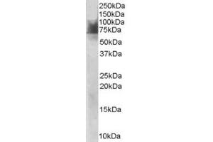 Western Blotting (WB) image for anti-Solute Carrier Family 6 (Neurotransmitter Transporter, serotonin), Member 4 (SLC6A4) (AA 116-126) antibody (ABIN297660) (SLC6A4 抗体  (AA 116-126))