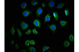 Immunofluorescence staining of A549 cells with ABIN7172278 at 1:166, counter-stained with DAPI. (TLR6 抗体  (AA 32-586))