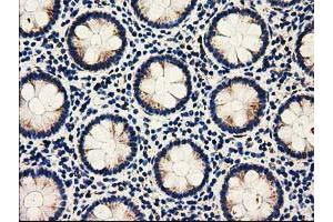 Immunohistochemistry (IHC) image for anti-Adenylate Kinase 3 (AK3) antibody (ABIN1496518) (Adenylate Kinase 3 抗体)