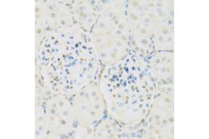 Immunohistochemistry of paraffin-embedded rat kidney using KAT2A antibody (ABIN5971244) at dilution of 1/100 (40x lens). (KAT2A 抗体)