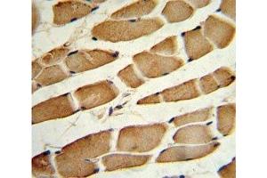 IHC analysis of FFPE human skeletal muscle stained with SMAD4 antibody (SMAD4 抗体  (AA 400-428))