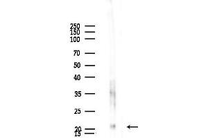 anti-Mitochondrial Ribosomal Protein L21 (MRPL21) (Internal Region) antibody
