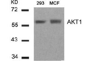 Image no. 3 for anti-V-Akt Murine Thymoma Viral Oncogene Homolog 1 (AKT1) (Thr450) antibody (ABIN319375) (AKT1 抗体  (Thr450))