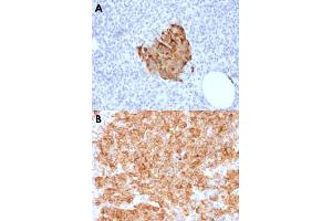 Immunohistochemical staining (Formalin-fixed paraffin-embedded sections) of human pancreas (A) and human parathyroid (B) with CHGA recombinant monoclonal antibody, clone CHGA/1773R . (Recombinant Chromogranin A 抗体)
