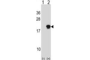 Western Blotting (WB) image for anti-Small Ubiquitin Related Modifier 4 (SUMO4) antibody (ABIN2996865) (SUMO4 抗体)