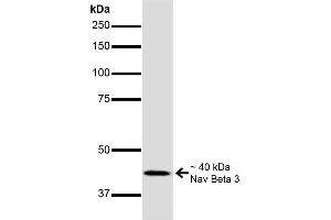 Western Blot analysis of Mouse Brain showing detection of ~40 kDa Nav Beta 3 protein using Mouse Anti-Nav Beta 3 Monoclonal Antibody, Clone S396-29 . (SCN3B 抗体  (AA 1-215))