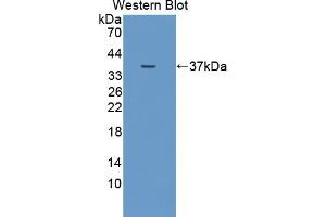 Detection of recombinant DUOX2 using Polyclonal Antibody to Dual Oxidase 2 (DUOX2) (DUOX2 抗体  (AA 1229-1517))
