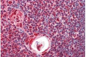 Anti-HnRNP K antibody IHC staining of human thymus. (HNRNPK 抗体  (AA 1-50))