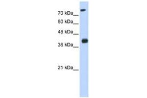 Image no. 1 for anti-ISL LIM Homeobox 2 (ISL2) (N-Term) antibody (ABIN6742917) (ISL2 抗体  (N-Term))