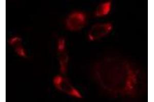 ABIN6275514 staining A549 cells by IF/ICC. (SCFD1 抗体  (C-Term))