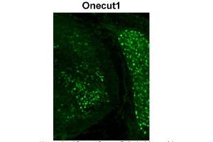 Immunohistochemistry (IHC) image for anti-One Cut Homeobox 1 (ONECUT1) (C-Term) antibody (ABIN2777516)