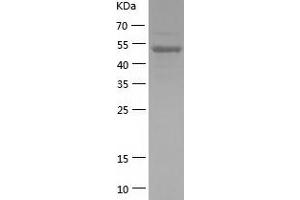Western Blotting (WB) image for Nuclear Factor of kappa Light Polypeptide Gene Enhancer in B-Cells 1 (NFKB1) (AA 2-434) protein (His tag) (ABIN7124204)