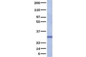Western Blotting (WB) image for Glial Cell Line Derived Neurotrophic Factor (GDNF) (Transcript Variant 1) (Active) protein (ABIN2721781)