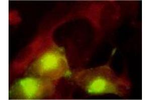 Immunofluorescence (IF) image for anti-Pp28 Tegument Protein (CMV Pp28) antibody (ABIN265539) (Pp28 Tegument Protein (CMV Pp28) 抗体)