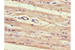 Immunohistochemistry of paraffin-embedded human heart tissue using ABIN7155128 at dilution of 1:100 (HNRPLL 抗体  (AA 1-72))