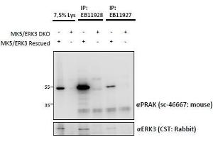 ABIN1590011 and EB11928 (1. (MAPKAP Kinase 5 抗体  (Internal Region))