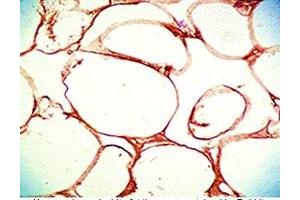 Human visceral white fat tissue was stained by Rabbit Anti-Vaspin (63-104) (Human) Serum (SERPINA12 抗体  (AA 63-104))