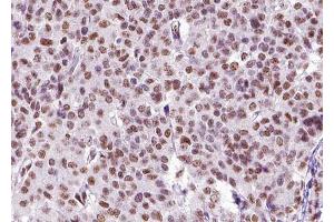 ABIN6268826 at 1/100 staining human liver tissue sections by IHC-P. (ZEB2 抗体  (N-Term))