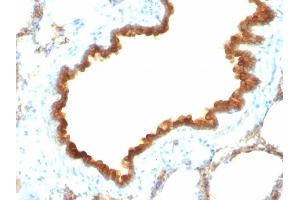 Immunohistochemistry (IHC) image for anti-Keratin 19 (KRT19) antibody (ABIN6939947)