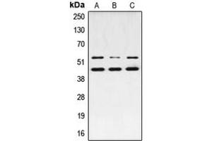 Western blot analysis of JNK1/2/3 (pT183) expression in MCF7 PMA-treated (A), NIH3T3 UV-treated (B), PC12 PMA-treated (C) whole cell lysates. (JNK 抗体  (pSer183))