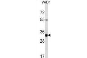 Western Blotting (WB) image for anti-Olfactory Receptor, Family 2, Subfamily W, Member 5 (OR2W5) antibody (ABIN2998137) (OR2W5 抗体)