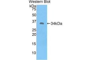 Western blot analysis of the recombinant protein. (MT1E 抗体  (AA 1-61))