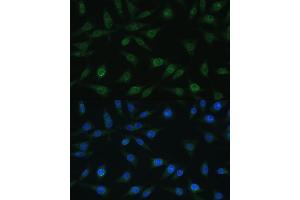 Immunofluorescence analysis of L929 cells using NUP98 antibody (ABIN1681142, ABIN3015191, ABIN3015192, ABIN5663696 and ABIN6213876) at dilution of 1:100.