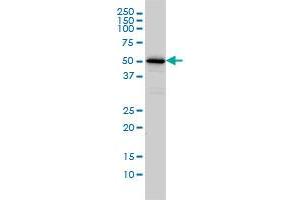 CAMKK1 monoclonal antibody (M01A), clone 1F6 Western Blot analysis of CAMKK1 expression in Jurkat . (CAMKK1 抗体  (AA 1-520))
