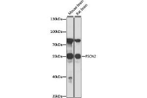 Western blot analysis of extracts of various cell lines, using FSCN2 antibody (ABIN7267143) at 1:1000 dilution. (Fascin 2 抗体  (AA 1-310))