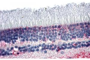 Anti-NR2E3 antibody  ABIN1049136 IHC staining of human retina. (NR2E3 抗体  (N-Term))