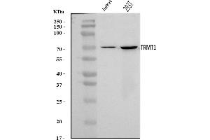 Western blot analysis of TRMT1 using anti-TRMT1 antibody (ABIN7602171).