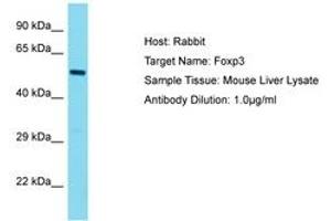 Image no. 1 for anti-Forkhead Box P3 (FOXP3) (AA 23-72) antibody (ABIN6750280) (FOXP3 抗体  (AA 23-72))
