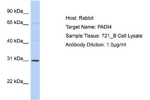 Host: Rabbit Target Name: PADI4 Sample Type: 721_B Cell lysates Antibody Dilution: 1. (PAD4 抗体  (Middle Region))