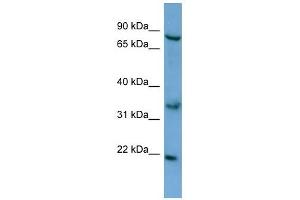 ABCD2 antibody used at 0. (CCL17 抗体  (N-Term))