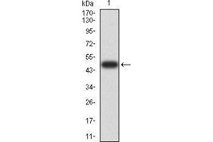 Western blot analysis using DHX58 mAb against human DHX58 (AA: 479-678) recombinant protein. (DHX58 抗体  (AA 479-678))