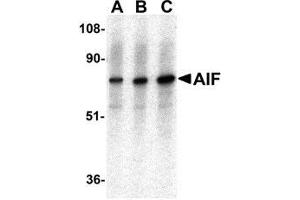Western blot analysis of AIF in K562 with AP30031PU-N AIF antibody at (A) 0. (AIF 抗体  (C-Term))
