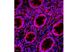 Immunofluorescence of paraffin embedded human colon using NAIF1 (ABIN7074867) at dilution of 1:650 (400x lens) (NAIF1 抗体)
